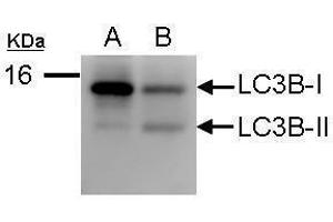 WB Image Sample (50 ug of whole cell lysate) A: Huh7   B: virus infected Huh7 12% SDS PAGE antibody diluted at 1:1000
