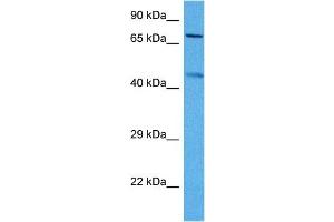 Image no. 3 for anti-Potassium Voltage-Gated Channel, KQT-Like Subfamily, Member 2 (KCNQ2) (Middle Region) antibody (ABIN2776304)