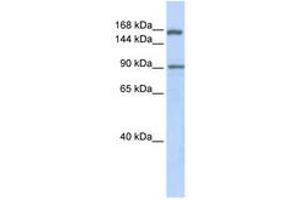 Image no. 1 for anti-AF4/FMR2 Family, Member 2 (AFF2) (AA 1224-1273) antibody (ABIN6740531)