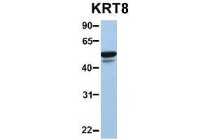 Image no. 6 for anti-Keratin 8 (KRT8) (Middle Region) antibody (ABIN2777113)