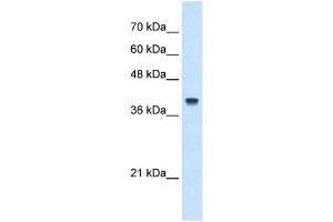 Image no. 3 for anti-Interferon-Induced Protein 44-Like (IFI44L) (N-Term) antibody (ABIN629863)