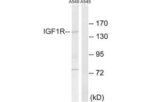 Image no. 3 for anti-Insulin-Like Growth Factor 1 Receptor (IGF1R) (Tyr1346) antibody (ABIN1848190)