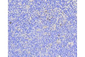Image no. 4 for anti-Antigen Identified By Monoclonal Antibody Ki-67 (MKI67) antibody (ABIN4904148)