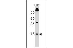 Image no. 1 for anti-Small Ubiquitin Related Modifier Protein 1 (SUMO1) antibody (ABIN6940847)
