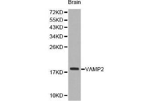 Western Blotting (WB) image for anti-Vesicle-Associated Membrane Protein 2 (Synaptobrevin 2) (VAMP2) (AA 1-100) antibody (ABIN1513674)