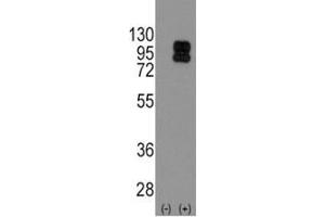 Image no. 2 for anti-CD19 Molecule (CD19) (AA 143-172) antibody (ABIN3030362)