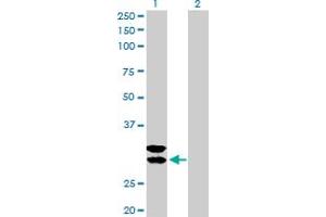 Image no. 1 for anti-Tryptase alpha/beta 1 (TPSAB1) (AA 1-275) antibody (ABIN521071)