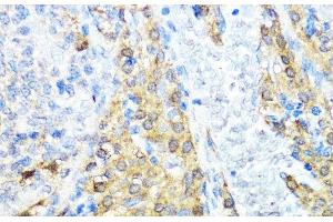 Immunohistochemistry of paraffin-embedded Rat ovary using NOD1 Polyclonal Antibody at dilution of 1:100 (40x lens).