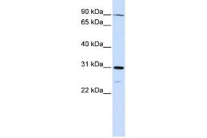 Image no. 1 for anti-LON Peptidase N-terminal Domain and Ring Finger 3 (LONRF3) (N-Term) antibody (ABIN2774784)