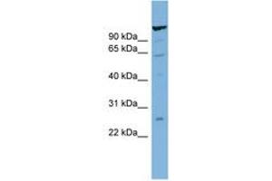 Image no. 1 for anti-CDNA Sequence BC051142 (BC051142) (C-Term) antibody (ABIN6742069)