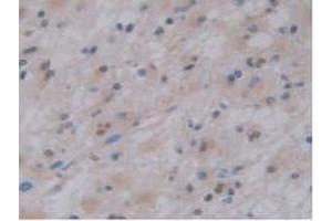 Image no. 3 for anti-Pancreas Specific Transcription Factor, 1a (PTF1A) (AA 177-328) antibody (ABIN2918928)