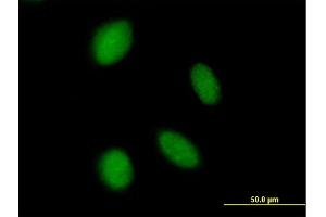 Image no. 1 for anti-Additional Sex Combs Like 2 (ASXL2) (AA 1-918) antibody (ABIN527453)