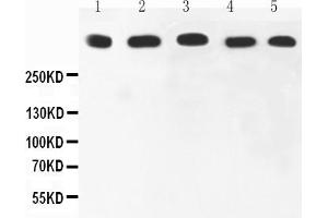 Image no. 1 for anti-Antigen Identified By Monoclonal Antibody Ki-67 (MKI67) (AA 2860-3256) antibody (ABIN3044570)