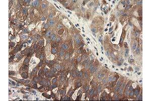 anti-Breast Cancer Anti-Estrogen Resistance 1 (BCAR1) antibody