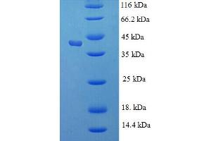 Image no. 1 for Kallikrein 1 (KLK1) (AA 25-262) protein (His-SUMO Tag) (ABIN5709809)