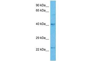 Image no. 3 for anti-Transcription Factor AP-2 gamma (Activating Enhancer Binding Protein 2 Gamma) (TFAP2C) (Middle Region) antibody (ABIN2777941)
