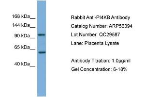 Image no. 1 for anti-Phosphatidylinositol 4-Kinase, Catalytic, beta (PI4KB) (Middle Region) antibody (ABIN2786678)