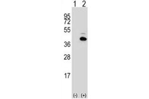 Image no. 5 for anti-Paired-Like Homeodomain 1 (PITX1) (AA 123-150) antibody (ABIN3032139)