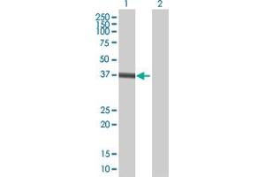 Image no. 1 for anti-ZW10 Interactor (ZWINT) (AA 1-277) antibody (ABIN524540)