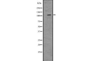 Image no. 2 for anti-Protein Kinase D2 (PKD2) antibody (ABIN6264428)
