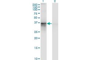 Image no. 1 for anti-Retinitis Pigmentosa 2 (X-Linked Recessive) (RP2) (AA 251-350) antibody (ABIN562683)