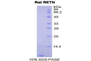 Image no. 1 for Resistin (RETN) (AA 45-114) protein (His tag) (ABIN1878214)