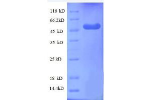 WD Repeat Domain 1 (WDR1) (AA 189-461), (partial) protein (GST tag)