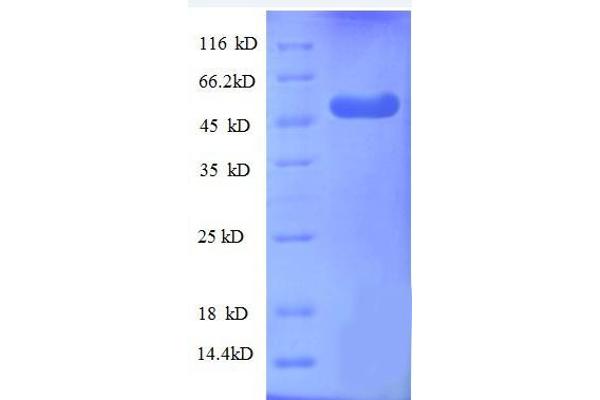 WDR1 Protein (AA 189-461, partial) (GST tag)