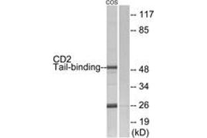 Image no. 1 for anti-CD2 (Cytoplasmic Tail) Binding Protein 2 (CD2BP2) (AA 101-150) antibody (ABIN1534312)