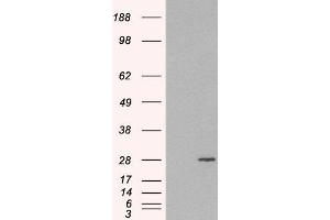Image no. 1 for anti-RAB11A, Member RAS Oncogene Family (RAB11A) (C-Term) antibody (ABIN184807)