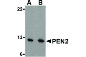 Image no. 1 for anti-Presenilin Enhancer 2 Homolog (PSENEN) (N-Term) antibody (ABIN6657118)