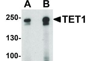 Image no. 1 for anti-Tet Methylcytosine Dioxygenase 1 (TET1) (C-Term) antibody (ABIN6657238)