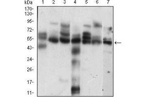 Image no. 3 for anti-Cyclin E1 (CCNE1) (AA 307-410) antibody (ABIN2682980)