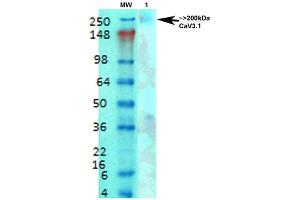 Image no. 2 for anti-Calcium Channel, Voltage-Dependent, T Type, alpha 1G Subunit (CACNA1G) (AA 2052-2172) antibody (Biotin) (ABIN2483301)