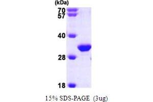 Image no. 1 for HIV-1 Tat Interactive Protein 2, 30kDa (HTATIP2) (AA 1-242) protein (His tag) (ABIN667152)