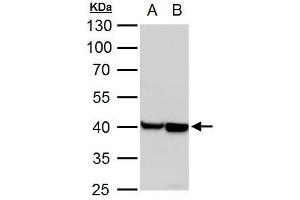 Image no. 1 for anti-Actin, Alpha, Cardiac Muscle 1 (ACTC1) (Center) antibody (ABIN2855212)