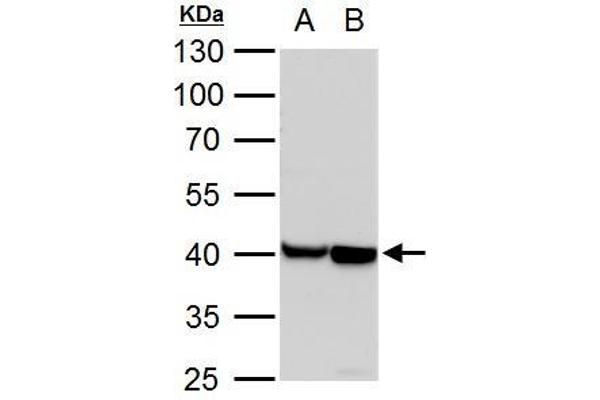 ACTC1 antibody  (Center)