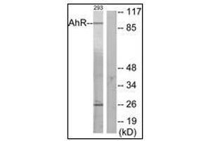Image no. 3 for anti-Aryl Hydrocarbon Receptor (AHR) (N-Term) antibody (ABIN615857)