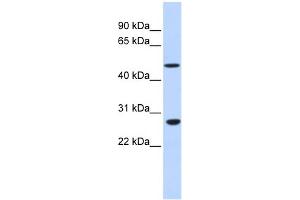 Image no. 1 for anti-Zinc Finger Protein 556 (ZNF556) (N-Term) antibody (ABIN2775013)