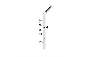 Image no. 3 for anti-Sphingosine-1-Phosphate Phosphatase 1 (SGPP1) (AA 13-42), (N-Term) antibody (ABIN657152)