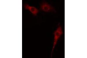 Image no. 3 for anti-Microtubule Associated serine/threonine Kinase 2 (MAST2) (Internal Region) antibody (ABIN6259237)