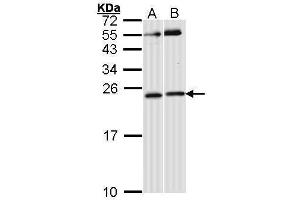 WB Image Sample (30 ug of whole cell lysate) A: Hela B: Raji 12% SDS PAGE antibody diluted at 1:1000