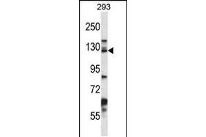 Image no. 2 for anti-Desmoglein 2 (DSG2) (AA 829-857), (C-Term) antibody (ABIN5531060)