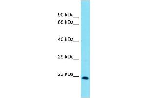Image no. 1 for anti-Homeobox, Msh-Like 3 (MSX3) (C-Term) antibody (ABIN2779957)