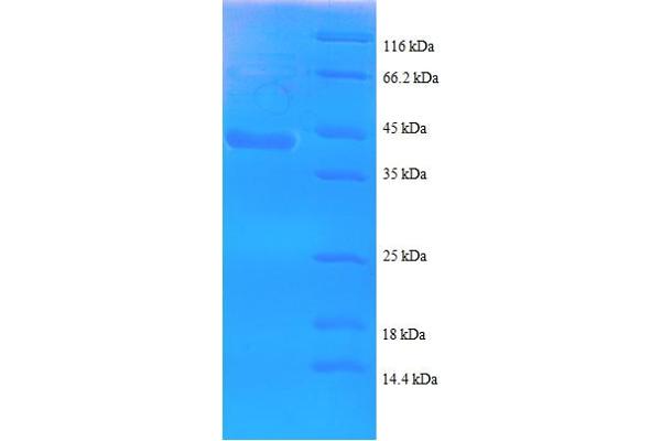 SPA17 Protein (AA 1-146, partial) (GST tag)