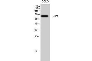 Image no. 1 for anti-Solute Carrier Family 39 (Zinc Transporter), Member 4 (SLC39A4) (Internal Region) antibody (ABIN3187537)