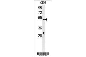 Image no. 1 for anti-Sister Chromatid Cohesion Protein DCC1 (DSCC1) (AA 311-339), (C-Term) antibody (ABIN650755)