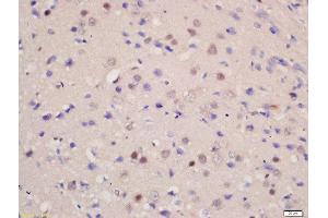 Formalin-fixed and paraffin embedded rat brain labeled with Rabbit Anti-SOD1 Polyclonal Antibody, Unconjugated  at 1:200 followed by conjugation to the secondary antibody and DAB staining