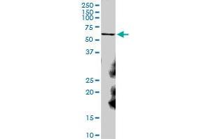 Image no. 1 for anti-Catalase (CAT) (AA 1-527) antibody (ABIN514034)