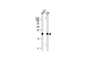 Image no. 1 for anti-GTPase NRas (NRAS) (AA 70-101), (N-Term) antibody (ABIN1882272)